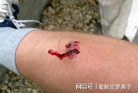 給狗狗打狂犬疫苗多少錢_給狗打疫苗多少錢狂犬_狗狗打的狂犬疫苗價格